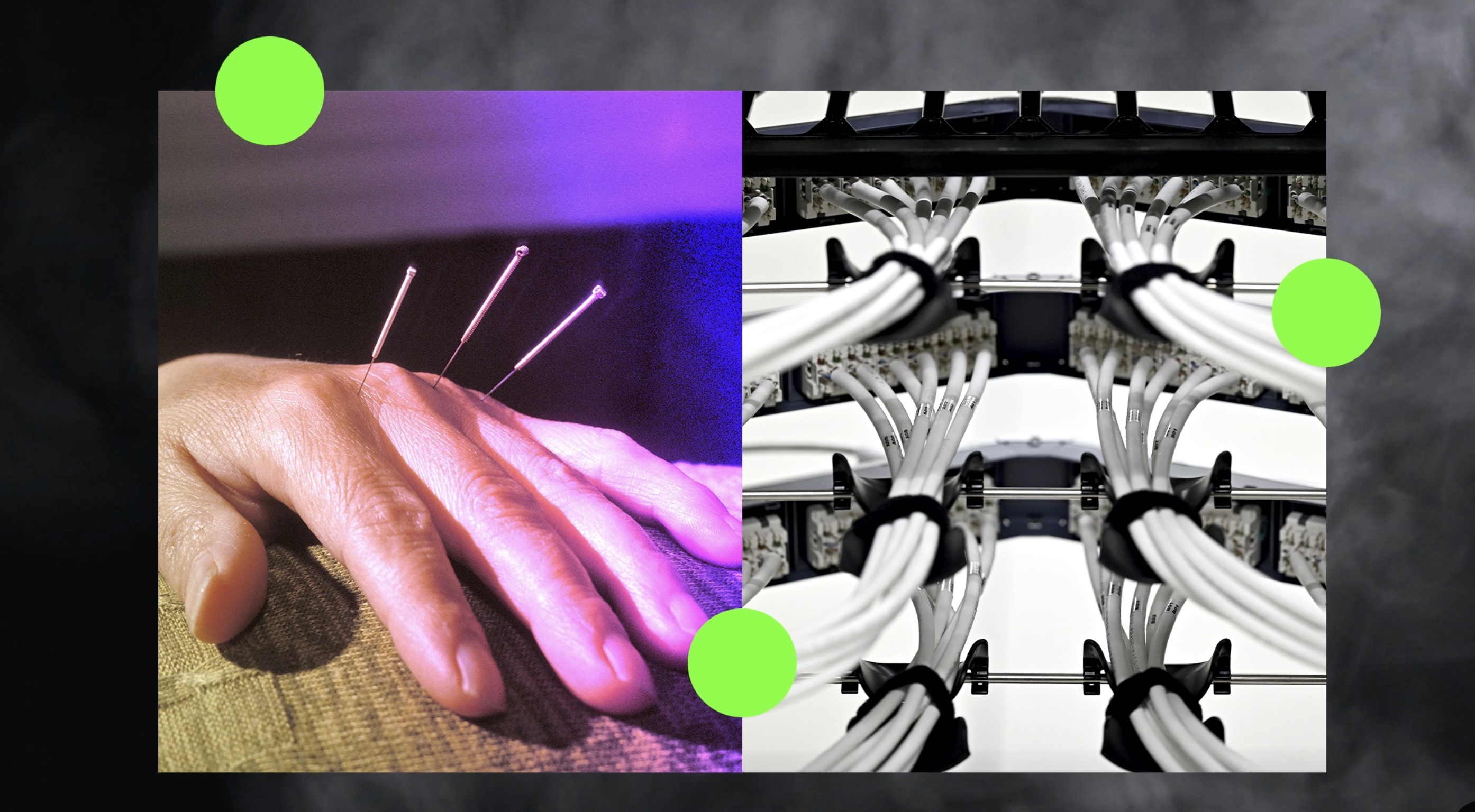 The Surprising Synergy Between Acupuncture and AI